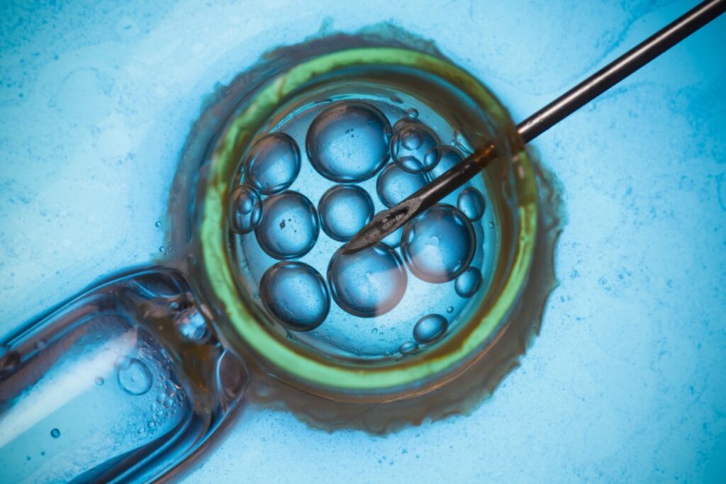 img-fiv-fertilizacao-in-vitro-crad-reproducao-assistida-dra-isabela-siqueira-medica-fertilidade-dourados-ms