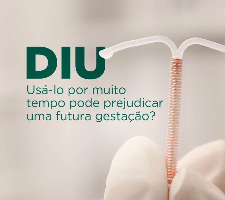 diu-usar-por-muito-tempo-afeta-uma-futura-gestacao-dra-isabela-siqueira-clinica-reproducao-humana-fiv-fertilizacao-in-vitro-dourados-ms